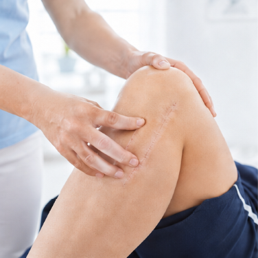 Vida-Medical-Terapia blizn